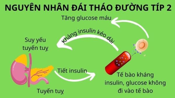 nguyên nhân bệnh tiểu đường tuýp 2
